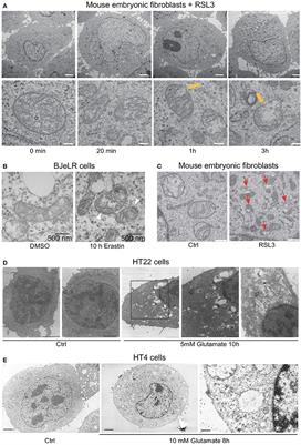 Oxytosis/Ferroptosis—(Re-) Emerging Roles for Oxidative Stress-Dependent Non-apoptotic Cell Death in Diseases of the Central Nervous System